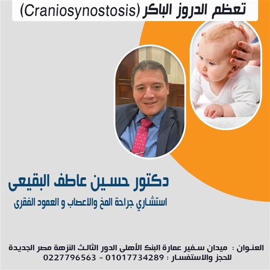  تعظم الدروز الباكر (Craniosynostosis)